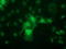 Phenylethanolamine N-Methyltransferase antibody, LS-C172947, Lifespan Biosciences, Immunofluorescence image 