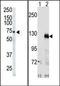 EPH Receptor A3 antibody, AP14277PU-N, Origene, Western Blot image 