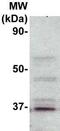 MYD88 Innate Immune Signal Transduction Adaptor antibody, TA354406, Origene, Western Blot image 