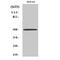 Abhydrolase Domain Containing 2 antibody, A11055, Boster Biological Technology, Western Blot image 