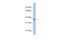 CMP-N-acetylneuraminate-beta-galactosamide-alpha-2,3-sialyltransferase 2 antibody, PA5-42928, Invitrogen Antibodies, Western Blot image 