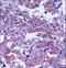 CD55 Molecule (Cromer Blood Group) antibody, LS-C168550, Lifespan Biosciences, Immunohistochemistry frozen image 