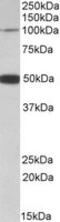 Patched Domain Containing 1 antibody, MBS422510, MyBioSource, Western Blot image 