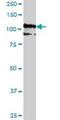 Protocadherin 10 antibody, H00057575-M07, Novus Biologicals, Western Blot image 