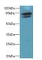 Trimethylguanosine Synthase 1 antibody, A51145-100, Epigentek, Western Blot image 