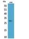 Apolipoprotein A1 antibody, STJ96804, St John