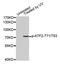 Activating Transcription Factor 2 antibody, MBS128377, MyBioSource, Western Blot image 