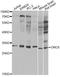 Origin Recognition Complex Subunit 6 antibody, A5426, ABclonal Technology, Western Blot image 
