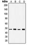 Inositol Hexakisphosphate Kinase 2 antibody, orb215178, Biorbyt, Western Blot image 
