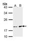 Fibroblast growth factor 21 antibody, PA5-29386, Invitrogen Antibodies, Western Blot image 