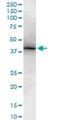 T-Box 6 antibody, H00006911-M16, Novus Biologicals, Western Blot image 