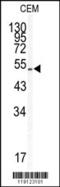 Kruppel Like Factor 5 antibody, 62-840, ProSci, Western Blot image 
