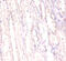 FUS RNA Binding Protein antibody, A51449-100, Epigentek, Immunohistochemistry paraffin image 