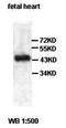 Acyl-CoA Dehydrogenase Short Chain antibody, orb77715, Biorbyt, Western Blot image 