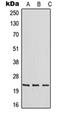 RAB30, Member RAS Oncogene Family antibody, orb215137, Biorbyt, Western Blot image 