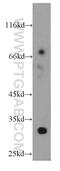 KIAA1191 antibody, 20637-1-AP, Proteintech Group, Western Blot image 