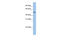 Solute Carrier Family 16 Member 6 antibody, ARP43883_P050, Aviva Systems Biology, Western Blot image 