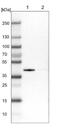 Solute Carrier Family 25 Member 33 antibody, NBP2-13323, Novus Biologicals, Western Blot image 