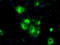 GDH antibody, M05856, Boster Biological Technology, Immunofluorescence image 