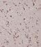 Cystathionine-Beta-Synthase antibody, A00130-2, Boster Biological Technology, Immunohistochemistry paraffin image 
