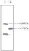 Peroxisome Proliferator Activated Receptor Delta antibody, ab23673, Abcam, Western Blot image 