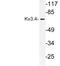 Potassium Voltage-Gated Channel Subfamily C Member 4 antibody, LS-C177762, Lifespan Biosciences, Western Blot image 