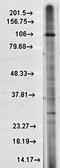 Transient Receptor Potential Cation Channel Subfamily M Member 2 antibody, orb67431, Biorbyt, Western Blot image 