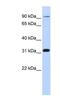 Cyclin And CBS Domain Divalent Metal Cation Transport Mediator 4 antibody, NBP1-59423, Novus Biologicals, Western Blot image 