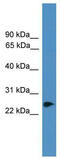 Ring Finger Protein 114 antibody, TA345260, Origene, Western Blot image 