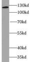 Integrin Subunit Alpha 3 antibody, FNab04345, FineTest, Western Blot image 