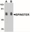 Protein spinster homolog 1 antibody, NBP2-41252, Novus Biologicals, Western Blot image 