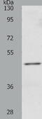 RCC1 Like antibody, TA322162, Origene, Western Blot image 