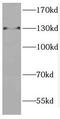 CTR9 Homolog, Paf1/RNA Polymerase II Complex Component antibody, FNab02063, FineTest, Western Blot image 