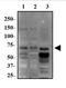 Ribosomal Protein S6 Kinase B1 antibody, NBP2-23649, Novus Biologicals, Western Blot image 