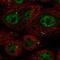 Coiled-Coil Domain Containing 92 antibody, NBP2-56862, Novus Biologicals, Immunofluorescence image 