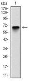 Glucose-6-Phosphate Dehydrogenase antibody, NBP2-22125, Novus Biologicals, Western Blot image 