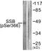 Small RNA Binding Exonuclease Protection Factor La antibody, PA5-38816, Invitrogen Antibodies, Western Blot image 