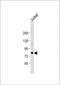 AlkB Homolog 8, TRNA Methyltransferase antibody, GTX81711, GeneTex, Western Blot image 