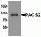Phosphofurin Acidic Cluster Sorting Protein 2 antibody, NBP2-81975, Novus Biologicals, Western Blot image 