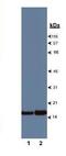 Profilin 1 antibody, GTX10608, GeneTex, Western Blot image 