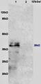 Interleukin-10 receptor subunit beta antibody, GTX37405, GeneTex, Western Blot image 