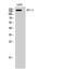 Lemur Tyrosine Kinase 2 antibody, A06144, Boster Biological Technology, Western Blot image 