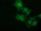 NSE2 (MMS21) Homolog, SMC5-SMC6 Complex SUMO Ligase antibody, M06693, Boster Biological Technology, Immunofluorescence image 