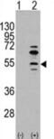 Myocyte-specific enhancer factor 2C antibody, abx032781, Abbexa, Western Blot image 