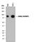 SH3 Domain Containing Kinase Binding Protein 1 antibody, MAB8877, R&D Systems, Western Blot image 