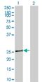 Tafazzin antibody, H00006901-M15, Novus Biologicals, Western Blot image 