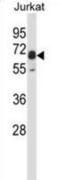 PX domain-containing protein kinase-like protein antibody, abx027842, Abbexa, Immunohistochemistry frozen image 