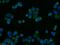Interleukin 22 Receptor Subunit Alpha 1 antibody, 13462-1-AP, Proteintech Group, Immunofluorescence image 