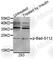 BCL2 Associated Agonist Of Cell Death antibody, AP0010, ABclonal Technology, Western Blot image 