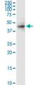 Receptor Activity Modifying Protein 3 antibody, H00010268-M02, Novus Biologicals, Western Blot image 
